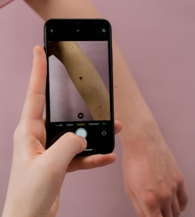 Skin Analysis